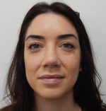 Rhinoplasty